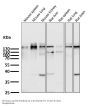 Anti-Acetyl-CoA Carboxylase Monoclonal Antibody