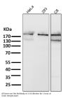 Anti-Acetyl-CoA Carboxylase Monoclonal Antibody