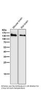 Anti-NMDAR1 GRIN1 Rabbit Monoclonal Antibody