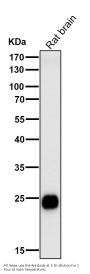 Anti-CD90 / Thy1 Rabbit Monoclonal Antibody