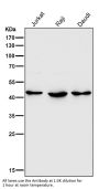 Anti-HDAC8/Histone Deacetylase 8 Rabbit Monoclonal Antibody