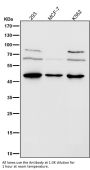 Anti-HDAC8/Histone Deacetylase 8 Rabbit Monoclonal Antibody