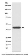 Anti-HDAC8/Histone Deacetylase 8 Rabbit Monoclonal Antibody