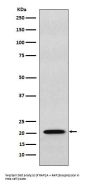 Anti-RAP1A + RAP1B Rabbit Monoclonal Antibody