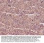 Anti-beta III Tubulin TUBB3 Rabbit Monoclonal Antibody