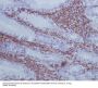 Anti-GAP43 Rabbit Monoclonal Antibody