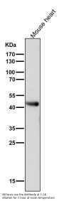 Anti-ADIPOR1 Rabbit Monoclonal Antibody