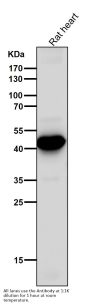 Anti-ADIPOR1 Rabbit Monoclonal Antibody