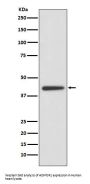 Anti-ADIPOR1 Rabbit Monoclonal Antibody