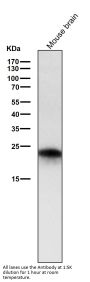 Anti-Rab5 RAB5A Rabbit Monoclonal Antibody