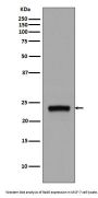 Anti-Rab5 RAB5A Rabbit Monoclonal Antibody