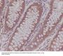 Anti-Rab5 RAB5A Rabbit Monoclonal Antibody
