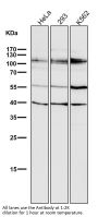 Anti-HDAC7/Histone Deacetylase 7 Rabbit Monoclonal Antibody