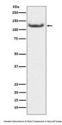 Anti-HDAC7/Histone Deacetylase 7 Rabbit Monoclonal Antibody
