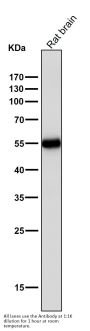 Anti-Tyrosine Hydroxylase TH Rabbit Monoclonal Antibody