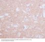 Anti-Tyrosine Hydroxylase TH Rabbit Monoclonal Antibody