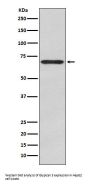 Anti-Glypican 3 Monoclonal Antibody