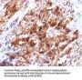 Anti-Glypican-3 (GPC3) (Hepatocellular Carcinoma Marker) Monoclonal Antibody