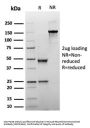 Anti-Glypican-3 (GPC3) (Hepatocellular Carcinoma Marker) Monoclonal Antibody