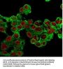 Anti-Glypican-3 (GPC3) (Hepatocellular Carcinoma Marker) Monoclonal Antibody