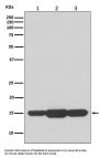 Anti-GABARAPL2 Rabbit Monoclonal Antibody