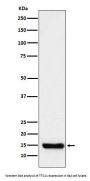 Anti-TTC11 Rabbit Monoclonal Antibody
