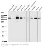 Anti-Integrin alpha 2 ITGA2 Rabbit Monoclonal Antibody