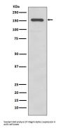 Anti-Integrin alpha 2 ITGA2 Rabbit Monoclonal Antibody