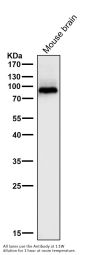 Anti-PKC beta 1 Rabbit Monoclonal Antibody