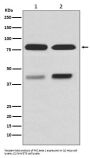 Anti-PKC beta 1 Rabbit Monoclonal Antibody