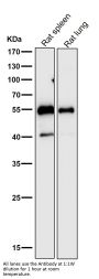 Anti-Desmin Rabbit Monoclonal Antibody