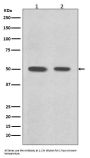 Anti-Desmin Rabbit Monoclonal Antibody