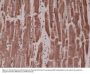 Anti-Desmin (DESM) Rabbit Monoclonal Antibody, Clone#RM234
