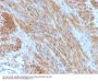 Anti-Desmin (Muscle Cell Marker) Monoclonal Antibody