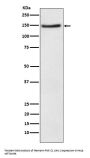 Anti-NPC1L1 Rabbit Monoclonal Antibody