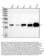 Anti-Ferritin Light Chain FTL Monoclonal Antibody