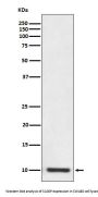Anti-S100P Rabbit Monoclonal Antibody