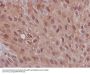 Anti-S100P Rabbit Monoclonal Antibody