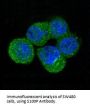 Anti-S100P Rabbit Monoclonal Antibody