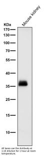 Anti-SFRP1 Rabbit Monoclonal Antibody