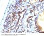 Anti-MAP3K1 (Mitogen-Activated Protein Kinase Kinase Kinase 1) Monoclonal Antibody