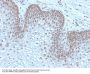 Anti-MAP3K1 (Mitogen-Activated Protein Kinase Kinase Kinase 1) Monoclonal Antibody