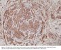 Anti-Alpha Actinin-4 ACTN4 Rabbit Monoclonal Antibody, Clone#RM287