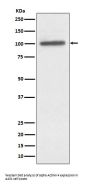 Anti-alpha Actinin 4 ACTN4 Monoclonal Antibody