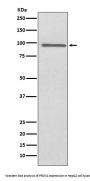 Anti-PROX1 Rabbit Monoclonal Antibody