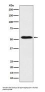 Anti-ApoH Rabbit Monoclonal Antibody