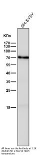Anti-GAD67 GAD1 Rabbit Monoclonal Antibody