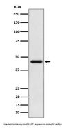 Anti-ACAT1 Rabbit Monoclonal Antibody