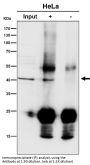 Anti-ACAT1 Rabbit Monoclonal Antibody