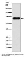 Anti-PCK1 Rabbit Monoclonal Antibody